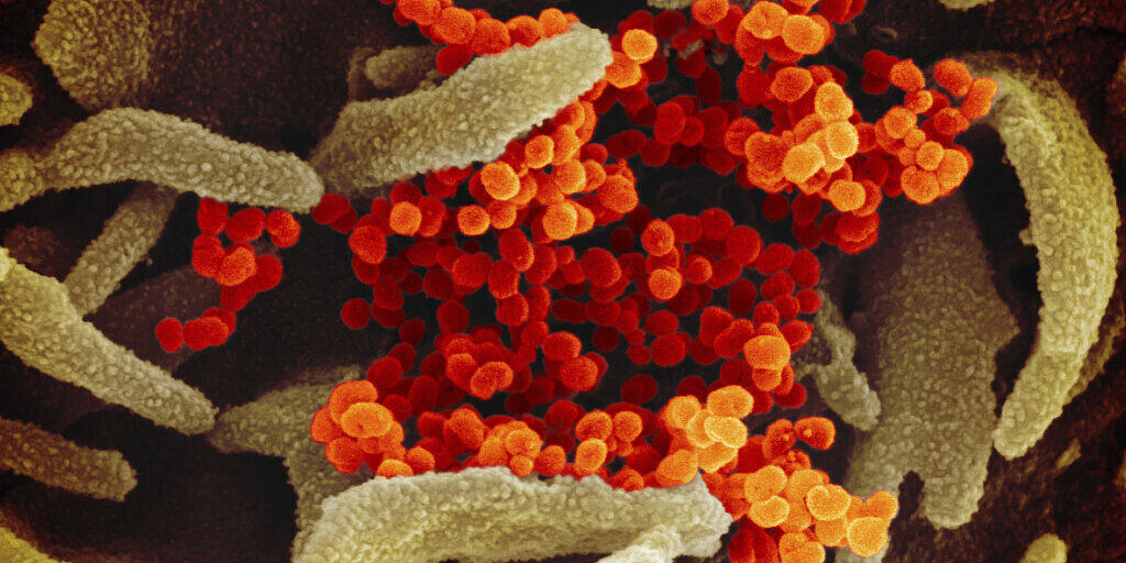 Trotz zunehmender Anzahl an Coronavirus-Erkrankten in Italien hat das Bundesamt für Gesundheit (BAG) für die Schweiz keine weiteren Massnahmen wegen des Virus getroffen.