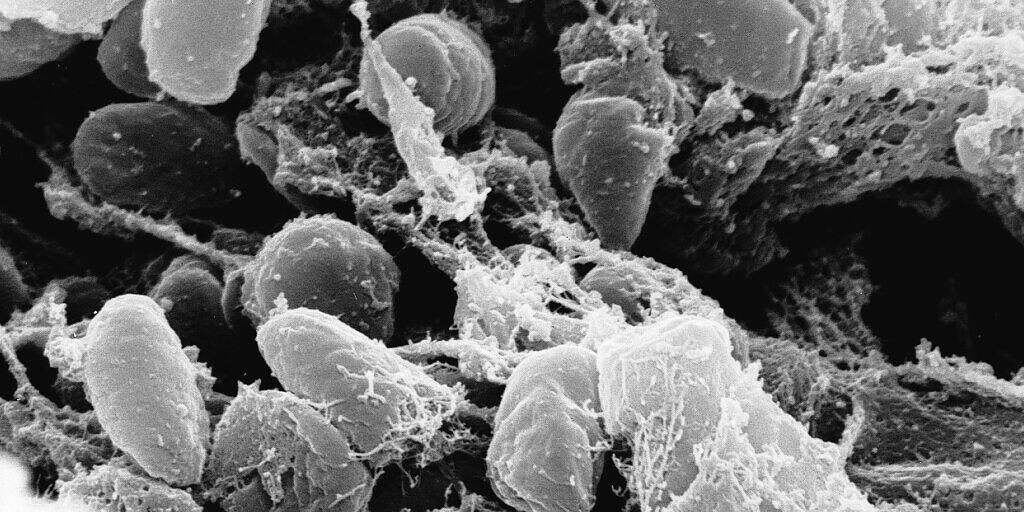 Eine Elektronenmikroskopaufnahme des Pesterregers Yersinia pestis. Forschende haben rekonstruiert, wie das Bakterium im 17. Jahrhundert in Venedig grassierte. (Archivbild)