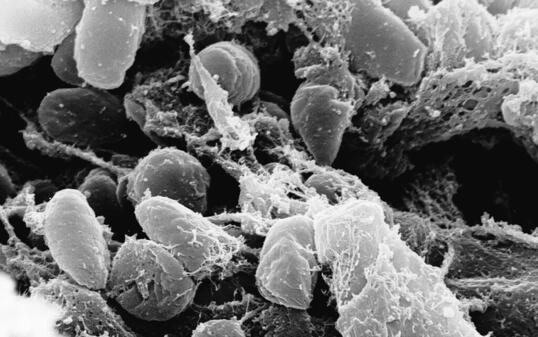 Eine Elektronenmikroskopaufnahme des Pesterregers Yersinia pestis. Forschende haben rekonstruiert, wie das Bakterium im 17. Jahrhundert in Venedig grassierte. (Archivbild)