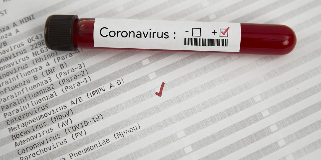 Positive blood test result for the new rapidly spreading Coronavirus