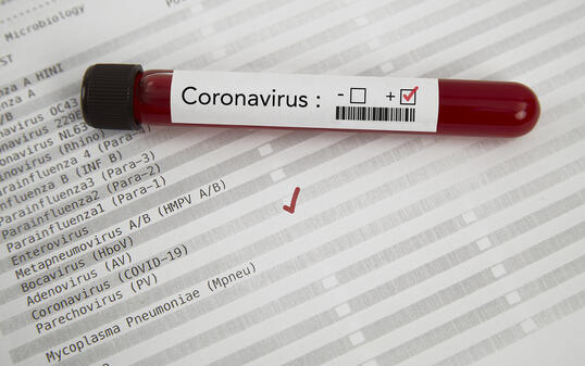 Positive blood test result for the new rapidly spreading Coronavirus
