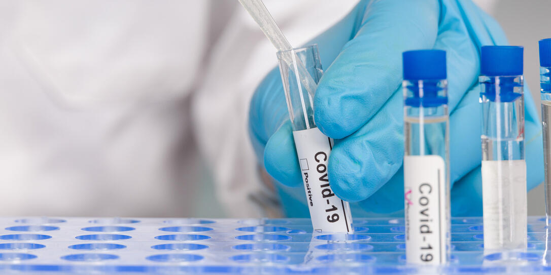 hand in blue gloves working with test tubes at virus analysis in a medical lab hand in blue gloves working with test tubes at virus analysis in a medical lab