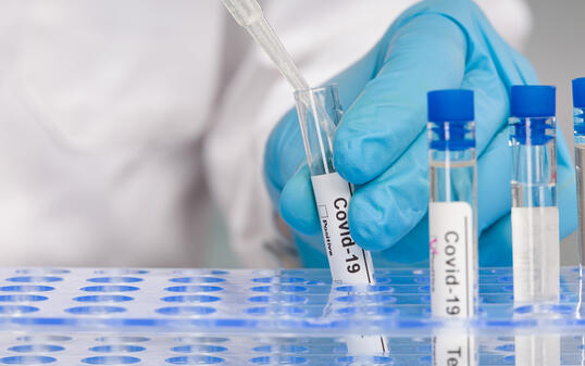 hand in blue gloves working with test tubes at virus analysis in a medical lab