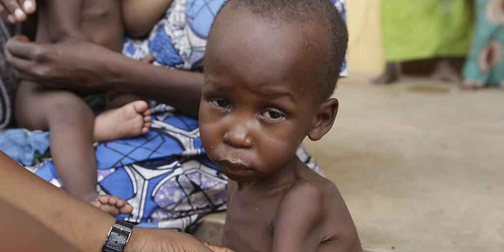Ein unterernährtes Kind wird in einem Flüchtlingslager medizinisch untersucht. Im Nordosten Nigerias haben die andauernden Angriffe der Terrormiliz Boko Haram eine schwere Hungerkrise ausgelöst. (Archiv)