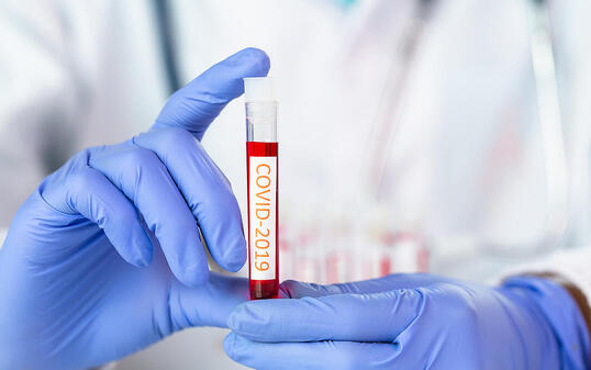 Doctor holding test tube with blood for 2019-nCoV analyzing. covid-19 virus, Coronavirus blood test Concept.