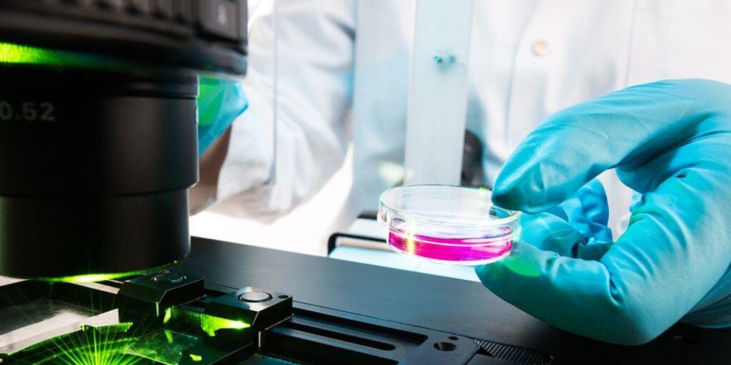 Die DNA-Reparaturmechanismen in Zellen wurden per Fluoreszenz-Mikroskopie untersucht.