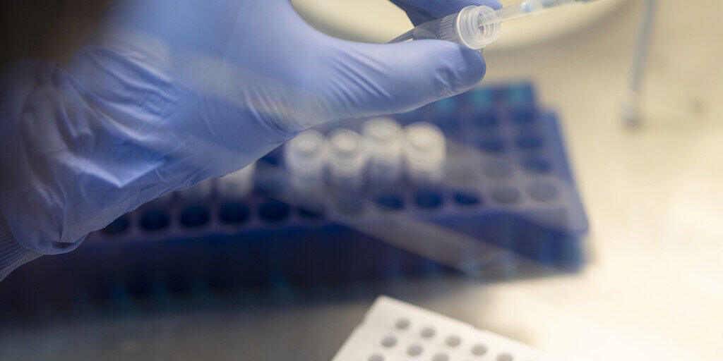 Wegen des Coronaviruses besteht in der Schweiz neu eine verschärfte Meldepflicht: Ärzte und Laboratorien müssen Fälle mit Verdacht auf eine Corona-Infektion innerhalb von zwei Stunden den Kantonen und dem Bund melden. (Archivbild) Wegen des Coronaviruses besteht in der Schweiz neu eine verschärfte Meldepflicht: Ärzte und Laboratorien müssen Fälle mit Verdacht auf eine Corona-Infektion innerhalb von zwei Stunden den Kantonen und dem Bund melden. (Archivbild)