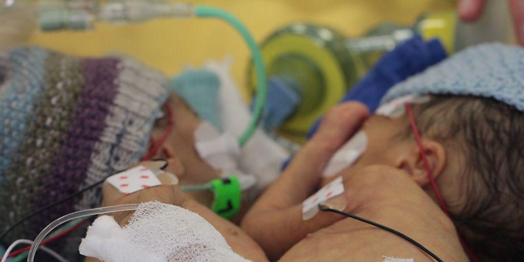 Den beiden M&auml;dchen gehe es soweit gut, sagte Steffen Berger, Chefarzt f&uuml;r Kinderchirurgie.