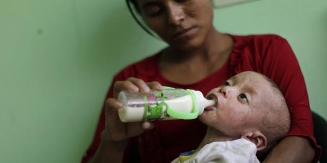 Mutter mit unterernährtem Sohn in Guatemala (Archivbild)