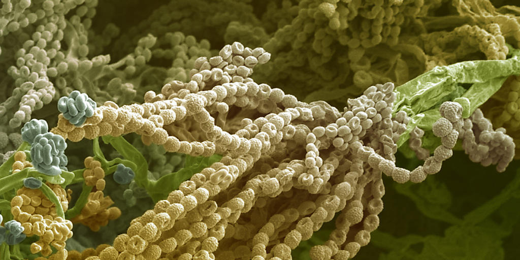 Antibiotika, die Wunderwaffen der Medizin, stammen von bodenbewohnenden Mikroorganismen wie dem Schimmelpilz Penicillium, der das Penicillin produziert Antibiotika, die Wunderwaffen der Medizin, stammen von bodenbewohnenden Mikroorganismen wie dem Schimmelpilz Penicillium, der das Penicillin produziert