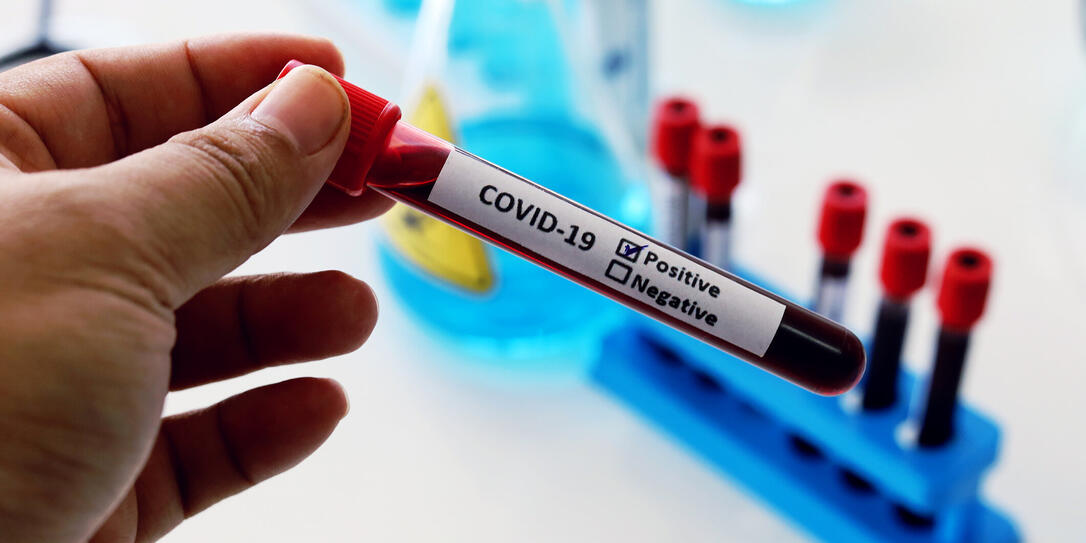 Concept corona virus vaccine simple for test solve COVID-19 in lab room at hospital.