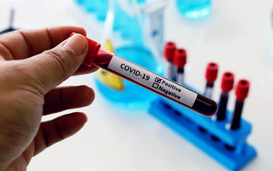 Concept corona virus vaccine simple for test solve COVID-19 in lab room at hospital.