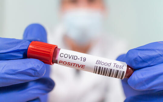 Coronavirus