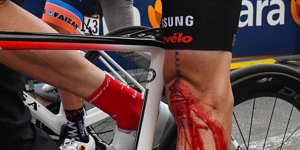Das arg lädierte Knie, welches Tom Dumoulin im Giro zur Aufgabe zwang