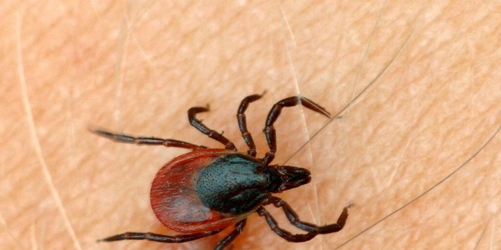 Eine Zecke auf der Haut eines Menschen. Einige der Blutsauger können das gefährliche Frühsommer-Meningoenzephalitis (FSME)-Virus übertragen. (Archivbild)