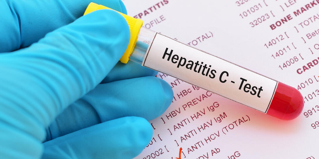 Hepatitis C virus (HCV) test