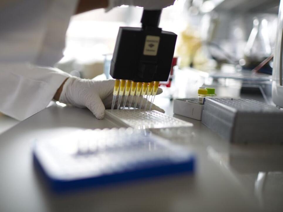 Zurzeit können HIV-Tests in der Schweiz nur im Labor durchgeführt werden, wie hier im Institut für Medizinische Virologie der Medizinischen Fakultät der Universität Zürich. (Archivbild)
