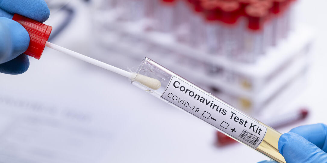 Coronavirus COVID 19 test novel corona virus healthcare worker testing samples