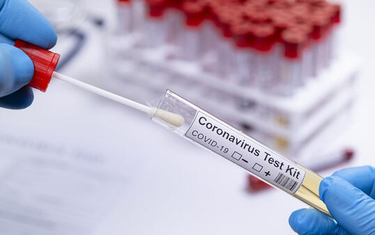 Coronavirus COVID 19 test novel corona virus healthcare worker testing samples