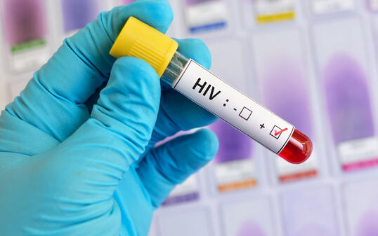 HIV positive blood sample