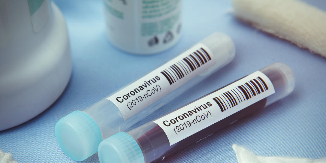 Coronavirus test Coronavirus test