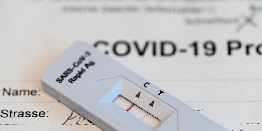 SCHNELLTEST, ANTIGEN-SCHNELLTEST, CORONA-SCHNELLTEST, COVID-19 SCHNELLTEST, TEST, SARS-COV-2 RAPID ANTIGEN TEST, CORONAVIRUS, VIRUS, COVID-19, COVID 19, SARS-COV-2, NCOV-2019, 2019-N-COV, TESTRESULTAT, TESTSTREIFEN, POSITIV, NASEN-RACHEN-ABSTRICH, SCHNELLTEST, ANTIGEN-SCHNELLTEST, CORONA-SCHNELLTEST, COVID-19 SCHNELLTEST, TEST, SARS-COV-2 RAPID ANTIGEN TEST, CORONAVIRUS, VIRUS, COVID-19, COVID 19, SARS-COV-2, NCOV-2019, 2019-N-COV, TESTRESULTAT, TESTSTREIFEN, POSITIV, NASEN-RACHEN-ABSTRICH,