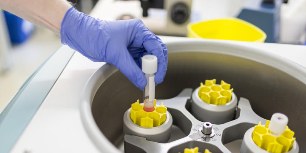 Vor einer k&uuml;nstlichen Befruchtung wird Spermienfl&uuml;ssigkeit in eine Zentrifuge gelegt, zur Abtrennung gut beweglicher Spermien.