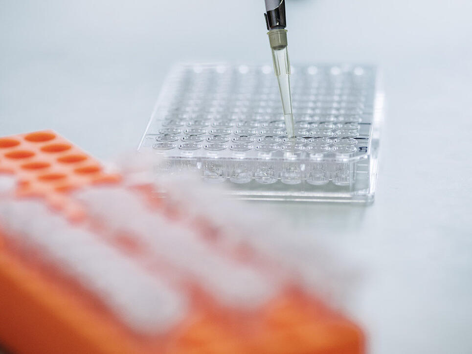 Das Interesse grosser Pharmaunternehmen an der Übernahme kleinerer Biotech-Firmen zuletzt gestiegen. (Symbolbild)