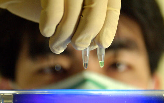 In der Schweiz stecken sich 2016 gegen 500 Menschen mit der tödlichen Lungenkrankheit an. (Symbolbild)