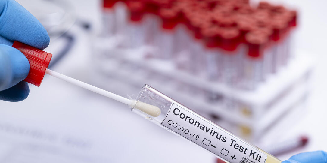 Coronavirus COVID 19 test novel corona virus healthcare worker testing samples