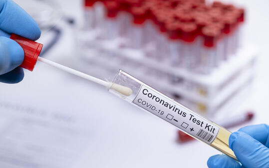 Coronavirus COVID 19 test novel corona virus healthcare worker testing samples