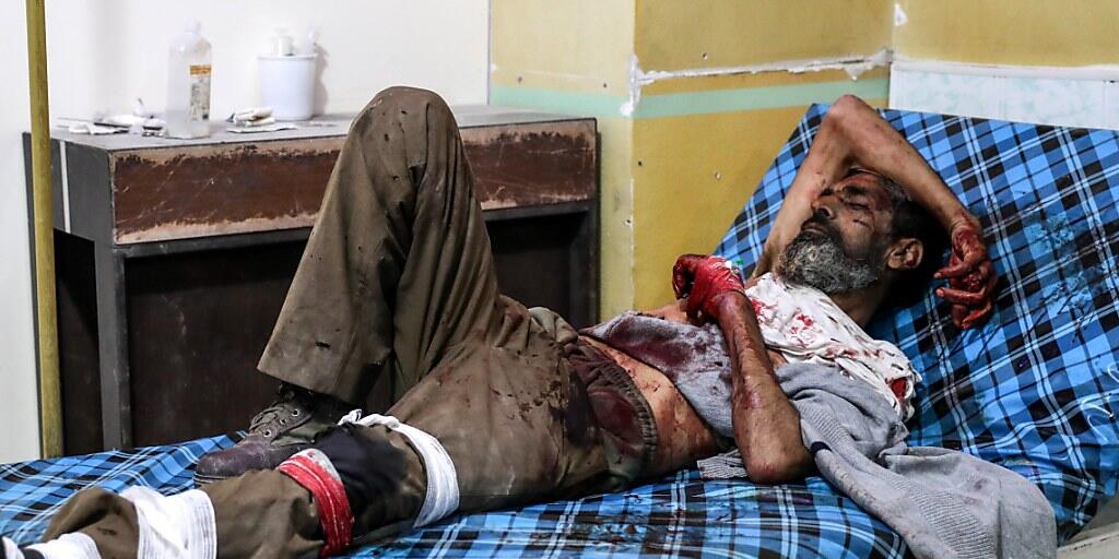 Eines der zahlreichen Opfer der Luftangriffe auf Ost-Ghouta während der vergangenen Tage liegt schwerverletzt im Spital (Aufnahme vom 26. November).