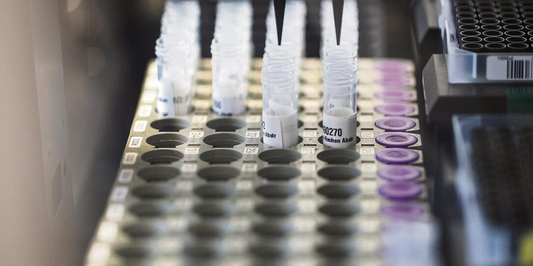 TEST, SPEICHELTEST, SELBSTENTNAHME, SELBSTENTNAHMETEST, CORONAVIRUS, COVID-19, COVID 19,