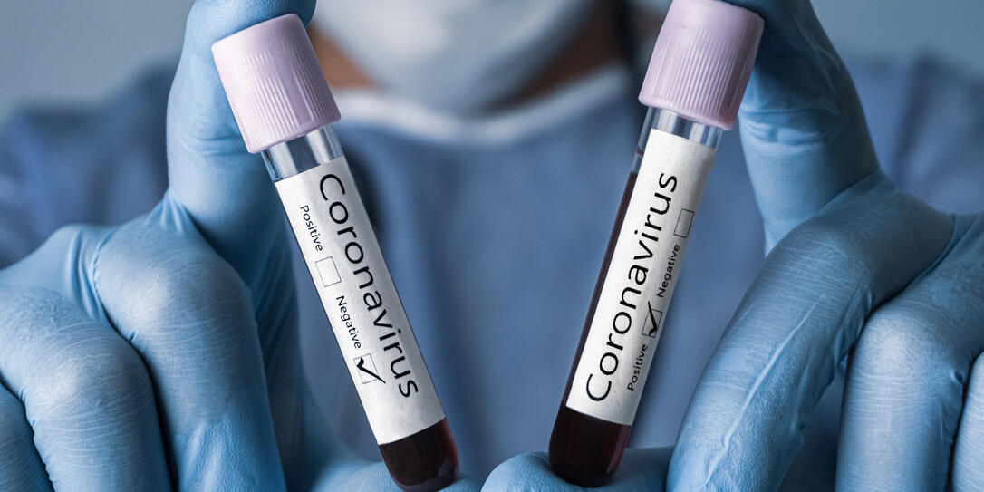 COVID-19 test and laboratory sample of blood testing for diagnosis new Corona virus infection. Positive and Negative results. Coronavirus concept.