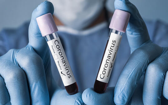 COVID-19 test and laboratory sample of blood testing for diagnosis new Corona virus infection. Positive and Negative results. Coronavirus concept.