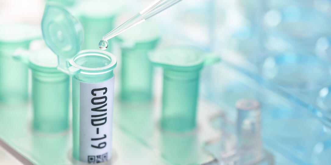 Coronavirus Test Coronavirus Test