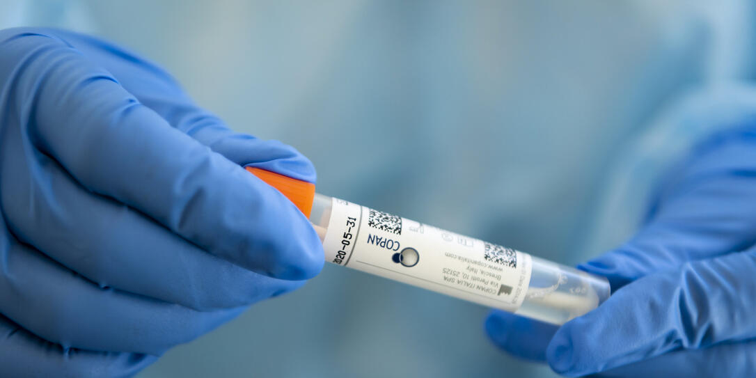 PATIENTENANNAHME, CORONAVIRUS, VIRUS, COVID-19, COVID 19, NCOV-2019, SPITAL SITTEN,