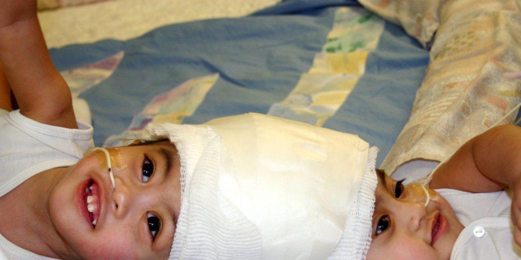 Gleiches Spital, andere Kinder: Bereits 2003 trennten Ärzte an der Klinik Montefiore in New York siamesische Zwillinge. (Archivbild)