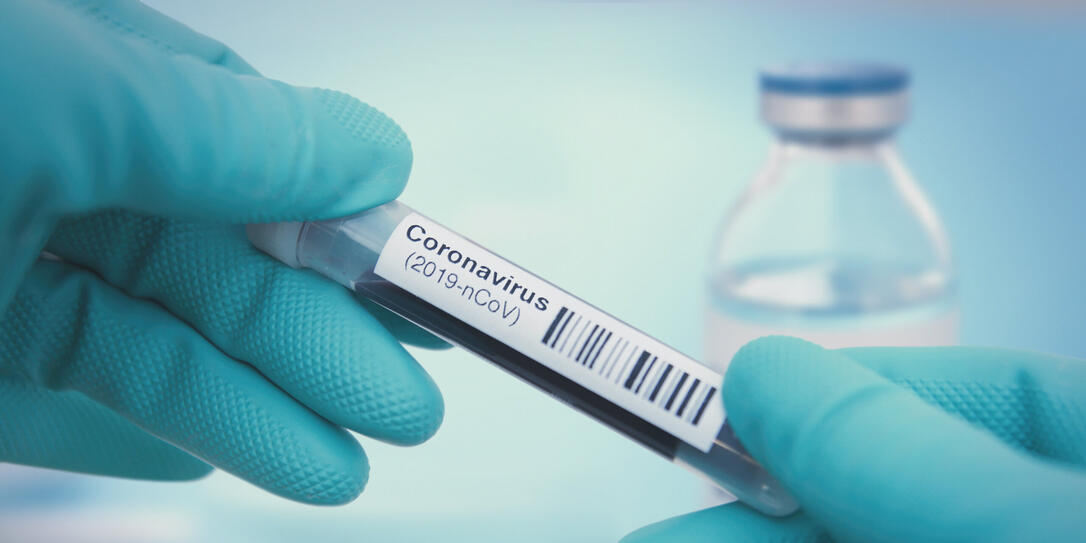 Coronavirus test