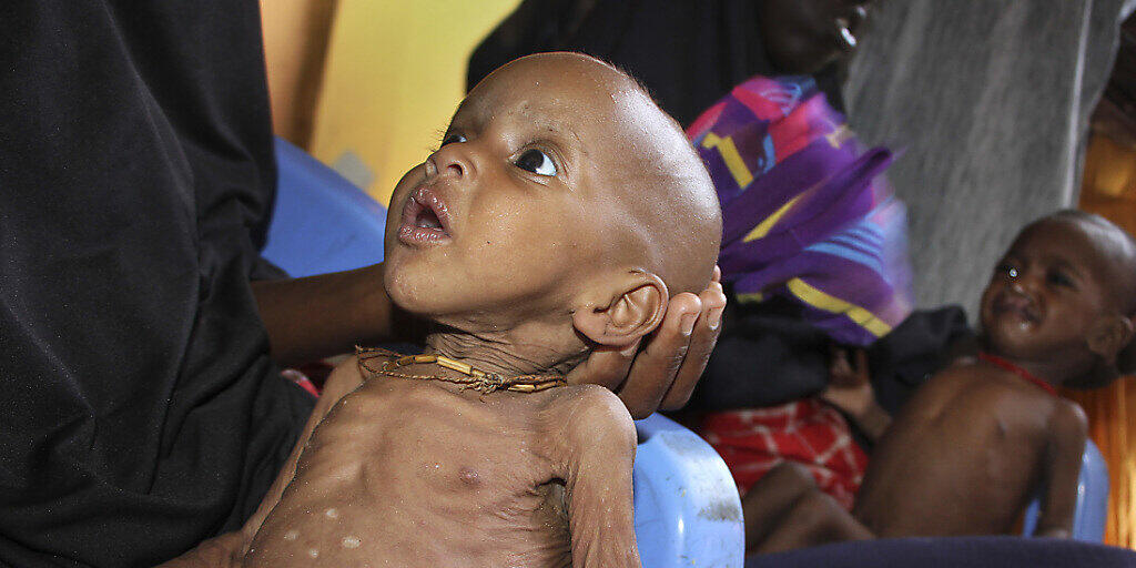 Ein unterern&auml;hrtes Kind in einem Lager nach der Flucht vor D&uuml;rre in Somalia. (Archivbild)