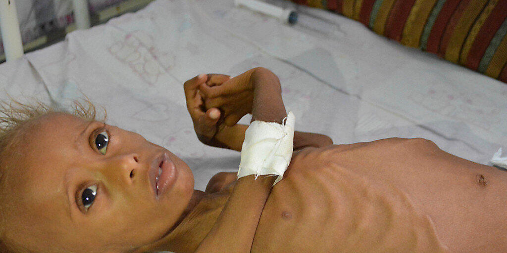 Unterernährtes Kind im Jemen: Das Kinderhilfswerk Unicef benötigt nach eigenen Angaben 3,9 Milliarden Dollar für Kinderhilfsprogramme in 59 Ländern. (Archivbild) Unterernährtes Kind im Jemen: Das Kinderhilfswerk Unicef benötigt nach eigenen Angaben 3,9 Milliarden Dollar für Kinderhilfsprogramme in 59 Ländern. (Archivbild)