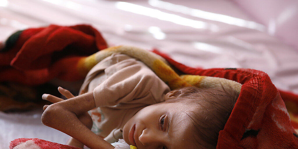 150'000 unterernährte Kinder könnten in den nächsten Monate sterben. (Archivbild)