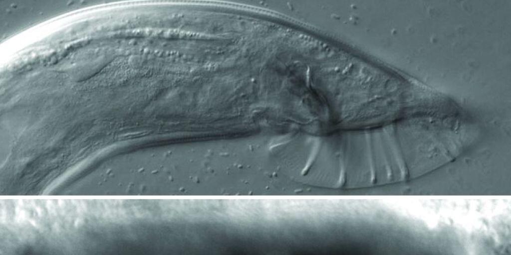 Die primären Geschlechtsorgane des Fadenwurms Caenorhabditis elegans, oben das männliche, unten das weibliche. Die Entschlüsselung des Geschlechtsreifungsprozesses von C. elegans soll laut Basler Forschern auch Rückschlüsse auf die menschliche Pubertät erlauben. (zVg)