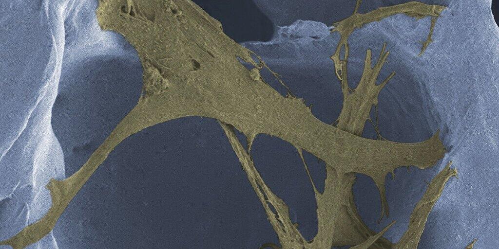 Im Gerüst des Polymerschaums finden Zellen - wie diese Fibroblasten - guten Halt, um neues Hautgewebe aufzubauen.
(Kolorierte Mikroskopaufnahme, Vergrösserung 1200-fach)
