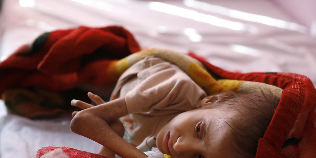 Unterernährtes Kind in einer Pflegestation in Sanaa (Archiv)
