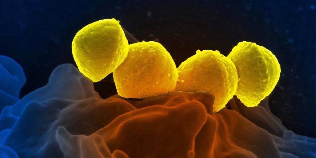 Ein neu entwickelter Verband tötet antibiotikaresistente Bakterien (gelb) in Wunden ab.