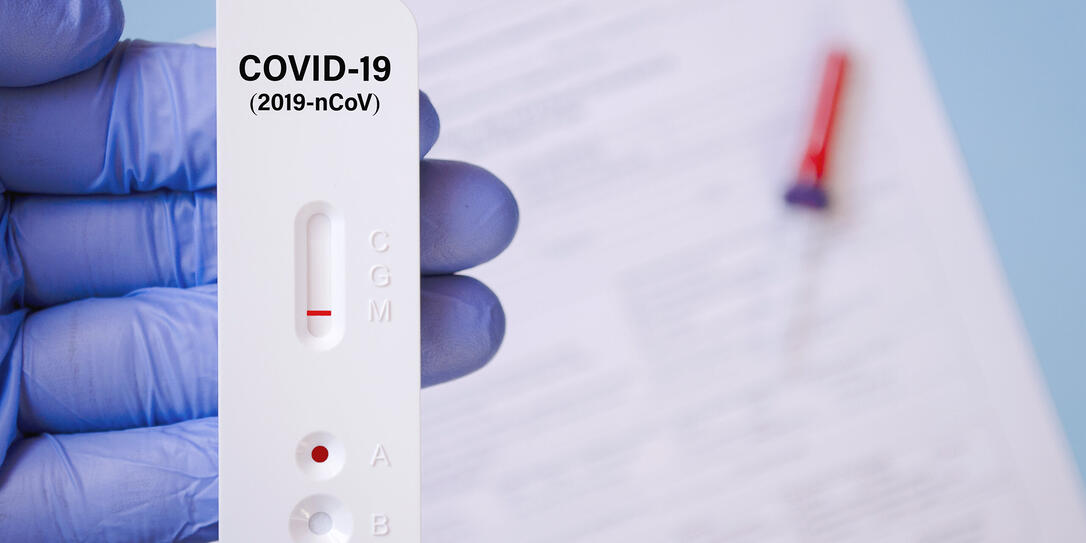 Positive test result by using rapid test for COVID-19, quick fast antibody point of care testing. Lab performing rapid diagnostic test for antibodies to detect presence of antigens COVID-19 disease.