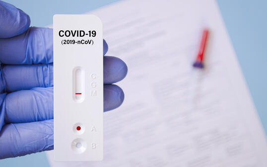 Positive test result by using rapid test for COVID-19, quick fast antibody point of care testing. Lab performing rapid diagnostic test for antibodies to detect presence of antigens COVID-19 disease.