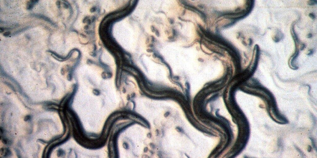 Der Fadenwurm Caenorhabditis elegans sieht bescheiden und ein bisschen eklig aus - aber er versorgt Forscher immer wieder mit Einsichten. Die neueste: Zwei Ribonukleinsäuren genügen, um aus einem ungeordneten Zellhaufen einen wohlgestalteten Embryo zu machen. (Archivbild) Der Fadenwurm Caenorhabditis elegans sieht bescheiden und ein bisschen eklig aus - aber er versorgt Forscher immer wieder mit Einsichten. Die neueste: Zwei Ribonukleinsäuren genügen, um aus einem ungeordneten Zellhaufen einen wohlgestalteten Embryo zu machen. (Archivbild)