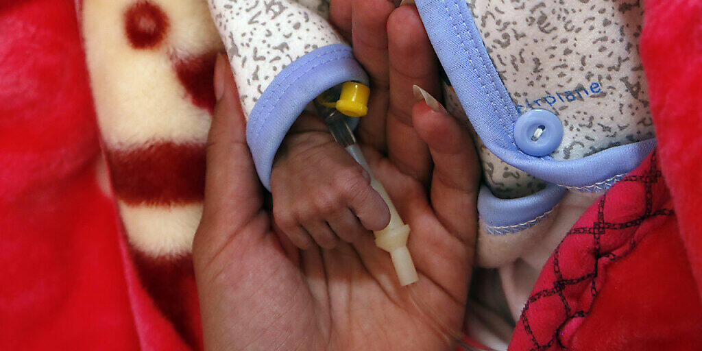 ARCHIV - Eine Frau hält das winzige Händchen ihres Babys, das auf der Station für unterernährte Kinder in einem Krankenhaus medizinisch versorgt wird. Die Vereinten Nationen legen am Montag, 13.07.2020 ihren neuen Bericht zur Welternährung mit den Zahlen zu Hunger und Unterernährung vor. Foto: Mohammed Mohammed/XinHua/dpa